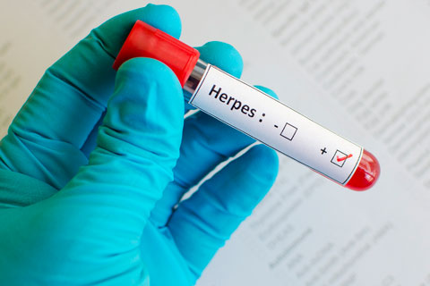 Echinacea HSV Effects Echinacea may help fight herpes viruses that cause genital, mouth, and eye infections.